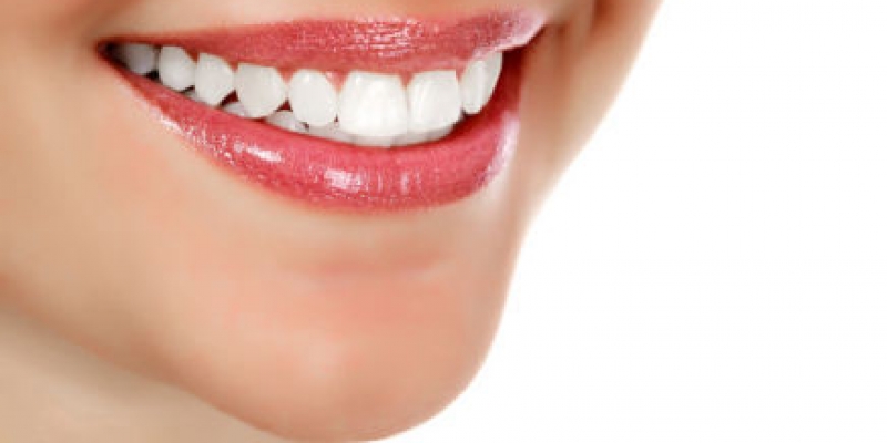 Laser Teeth Whitening